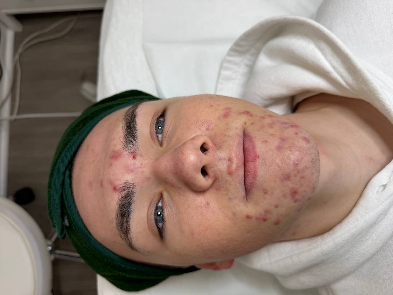 Skin at H.A. Skin Lab, treatment photo