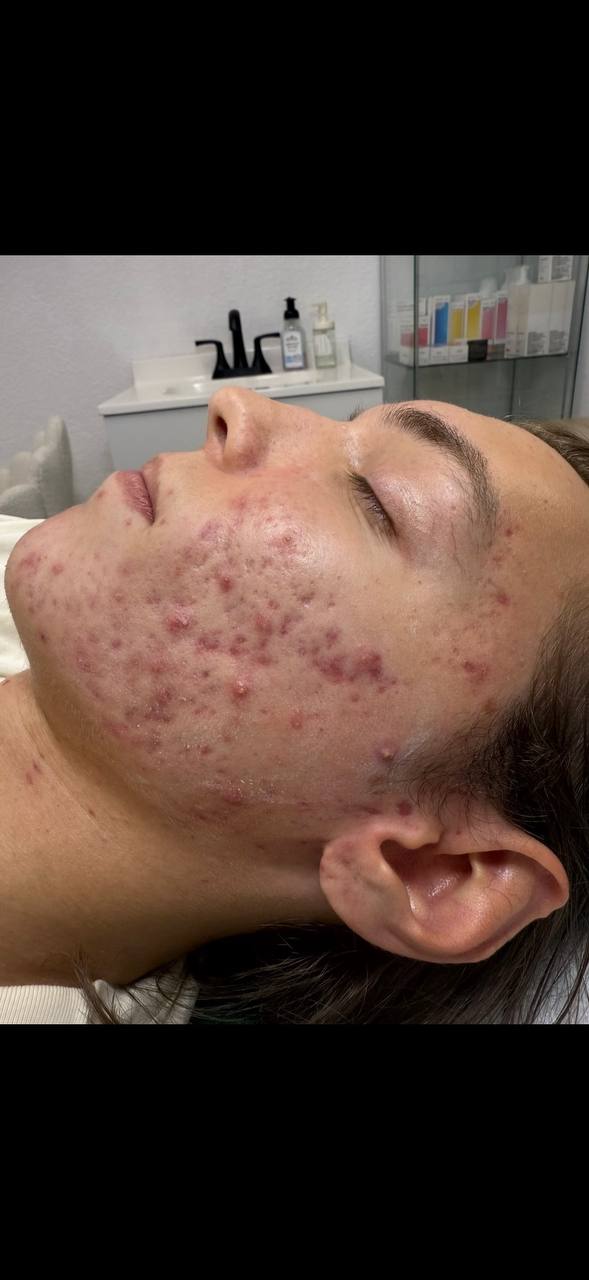 Inside the H.A. Skin Lab treatment room