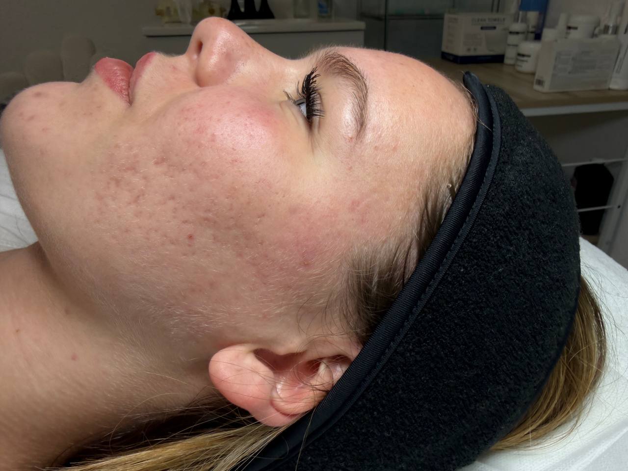 Client during a professional facial