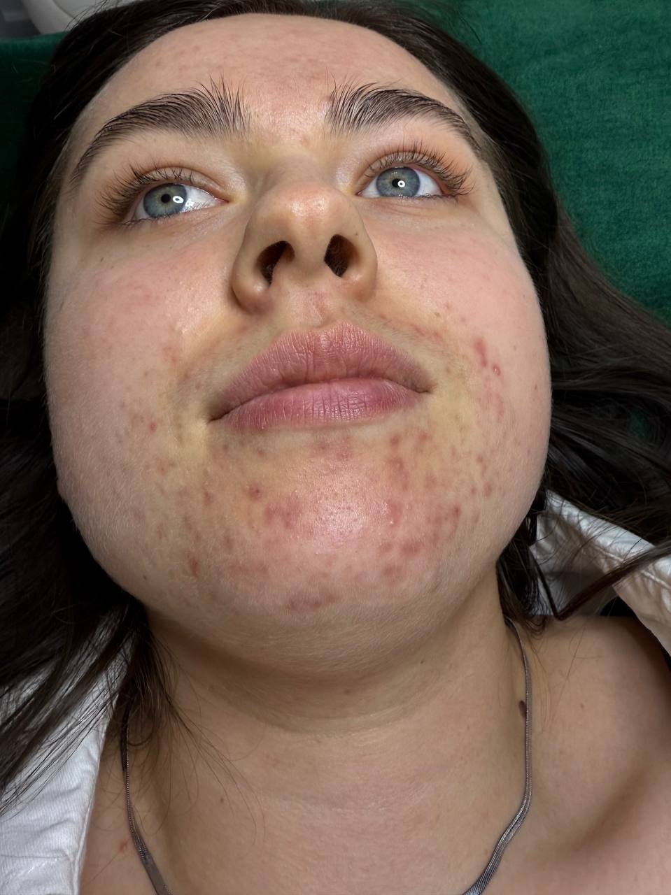 Skin at H.A. Skin Lab, treatment photo