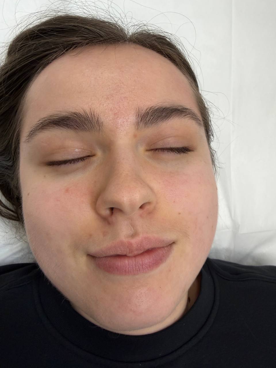 Skin at H.A. Skin Lab, treatment photo
