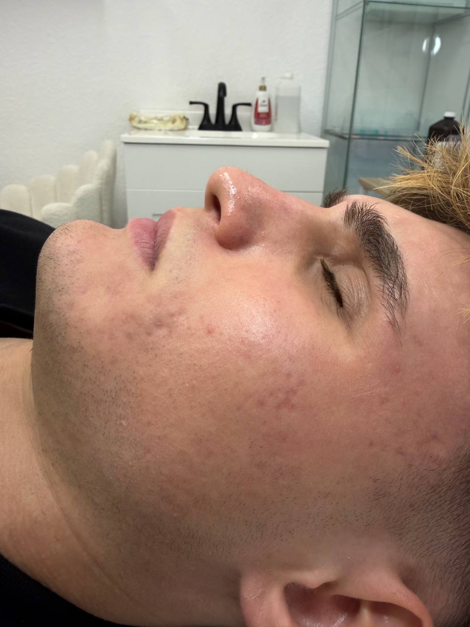 Calm, clearer skin after a session