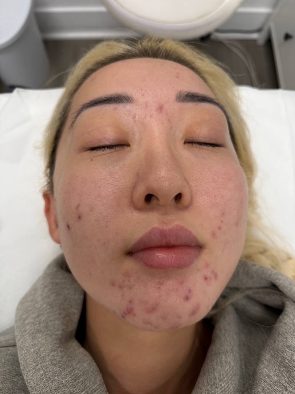 Skin at H.A. Skin Lab, treatment photo