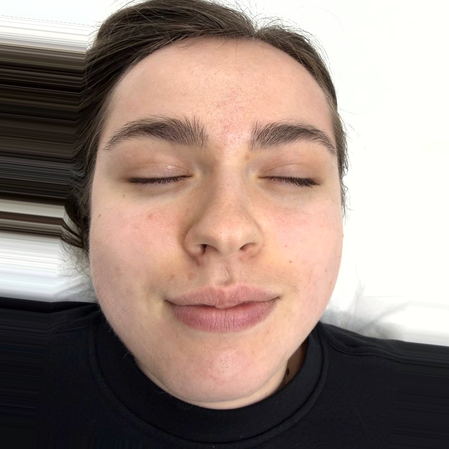 Same client after treatment